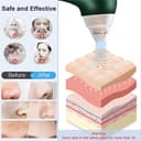 Blackhead Remover Pore Vacuum Cleaner with Camera