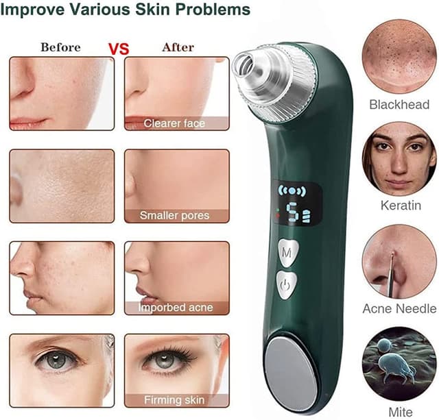 Blackhead Remover Pore Vacuum Cleaner with Camera