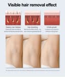 Lescolton IPL 350000Flash Permanent Hair Remover For Home Use