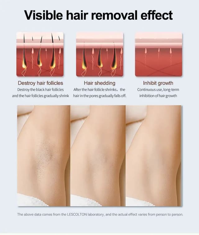 Lescolton IPL 350000Flash Permanent Hair Remover For Home Use