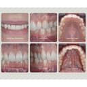 مجموعة معدات التصوير لأطباء الأسنان 500 لقطة جودوكس Godox MF12 Dental Kit for Sony with Trigger