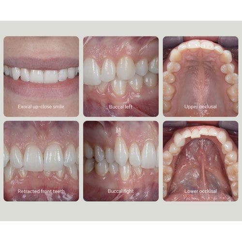 مجموعة معدات التصوير لأطباء الأسنان 500 لقطة جودوكس Godox MF12 Dental Kit for Sony with Trigger